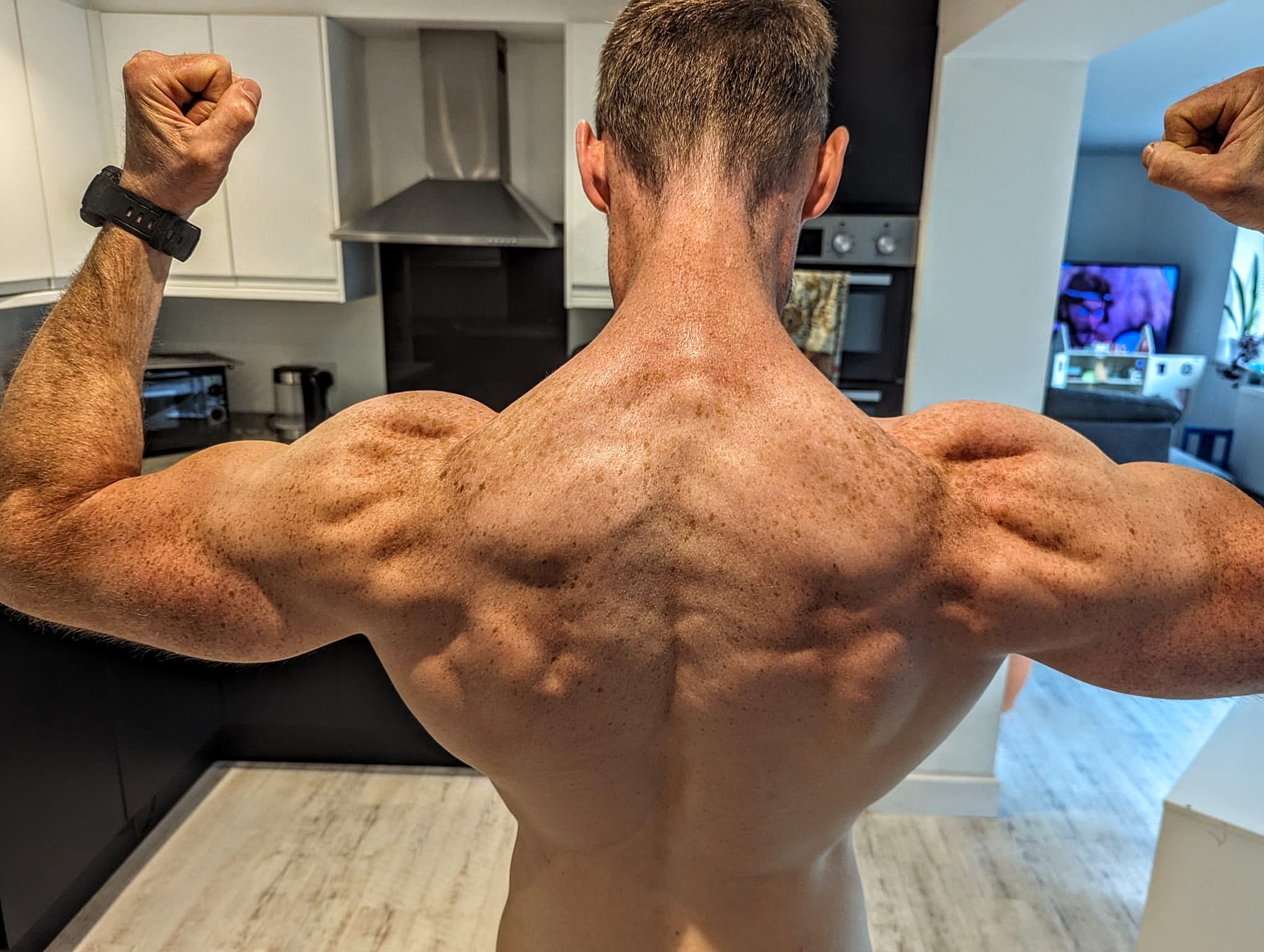 5 Proven Steps to building muscle with Hyperthyroidism, taming that thyroid Beast